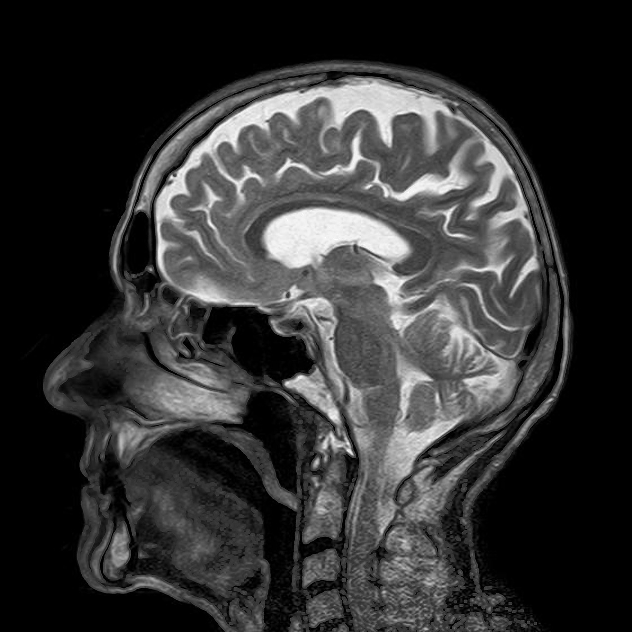 Jak wygląda badanie MRI (rezonans magnetyczny)